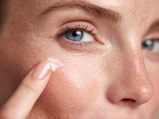 Kobieta z trądzikiem rózowatym nakłada dedykowany krem na policzek.