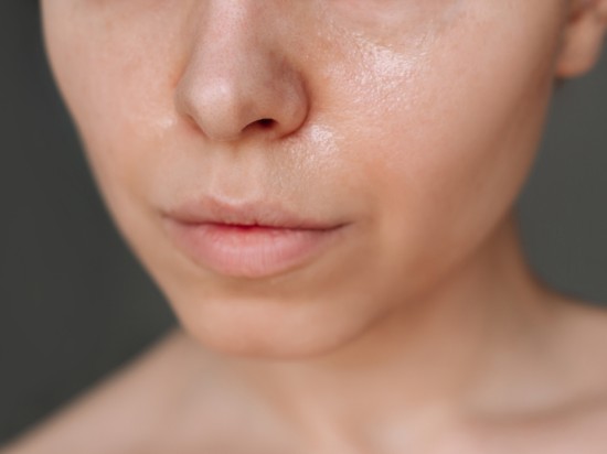 Zbliżenie na kobiecą twarz prezentujące skórę tłustą.
